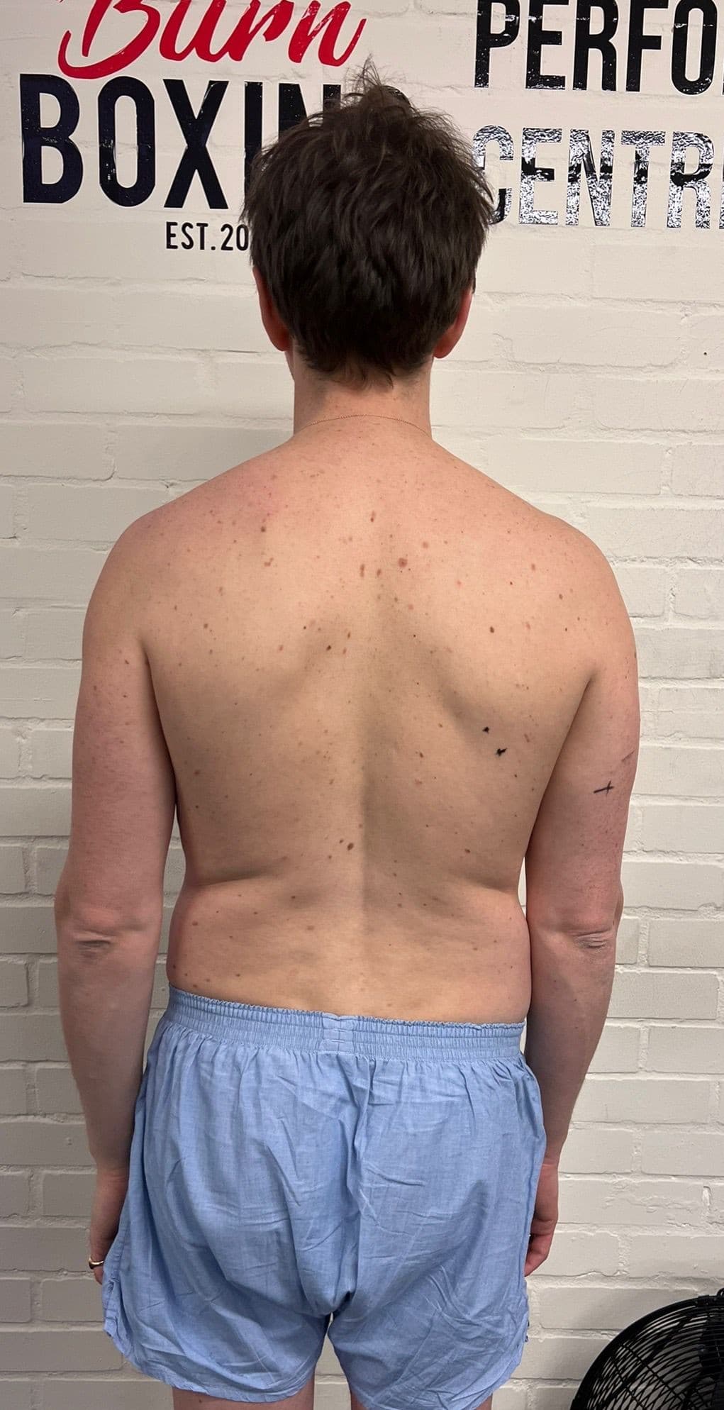 Before transformation