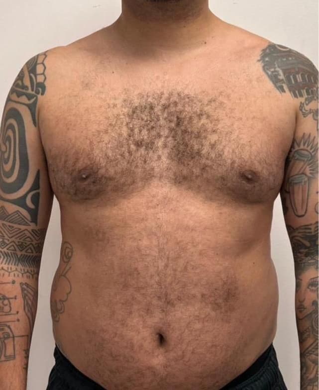 Before transformation